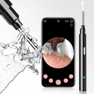 1080P Ear Wax Removal Otoscopes 360 Degree Wide Angle Visual Earwax Removal Camera Ear Cleaner Wireless Otoscope – Black 1080P Ear Wax Removal Otoscopes 360 Degree Wide Angle Visual Earwax Removal Camera Ear Cleaner Wireless Otoscope – Black